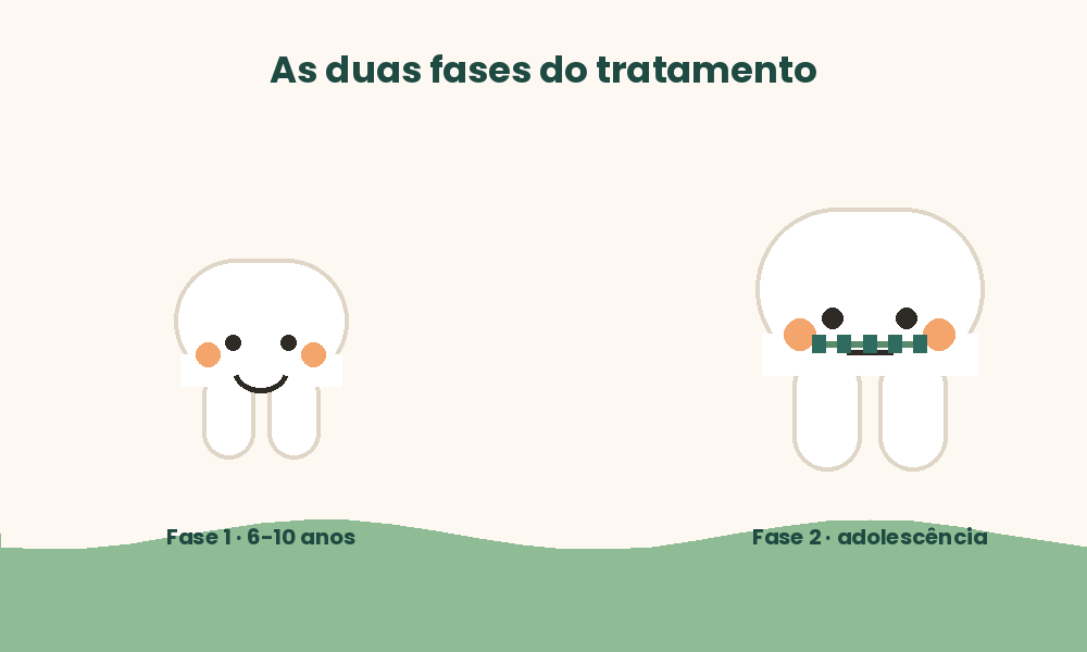 Linha do tempo animada mostrando as duas fases do tratamento ortodôntico infantil: fase interceptiva na infância e fase corretiva na adolescência